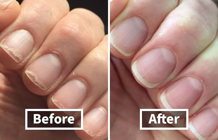 Ditch The Hangnails And Embrace The Nail-Vana With This Miracle-Working   <a Style="Display:inline;" Href="Https://Www.amazon.com/Cnd-Essentials-Nail-Cuticle-Solaroil/Dp/B0037mimlw?ie=utf8&linkcode=ll1&tag=bpsquid-20&linkid=919798bae278edaa0cfad0ce660c90c9&language=en_us&ref_=as_li_ss_tl " Target="_blank"><span Style="Font: Inherit; Color: #d74b1f;"> Cuticle Oil</Span>!