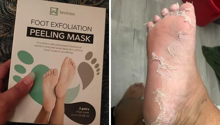 Calluses And Cracks, Be Gone! This   <a Style="Display:inline;" Href=" Https://Www.amazon.com/Foot-Peel-Mask-Cracked-Feet/Dp/B074mnf659?ie=utf8&th=1&linkcode=ll1&tag=bpmonkey-20&linkid=8e098e61e011e3bf7a2aaa0be067b0f2&language=en_us&ref_=as_li_ss_tl " Target="_blank"><span Style="Font: Inherit; Color: #d74b1f;"> Foot Peel Mask</Span> Is The Shedding Solution Your Feet Have Been Waiting For