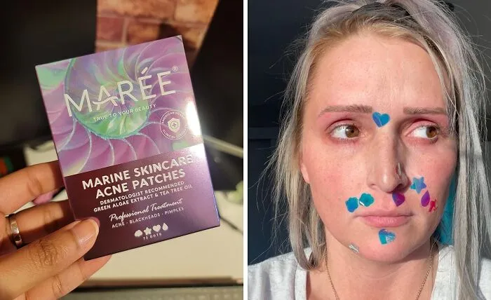 Zits And Breakouts Are Officially Cancelled! These   <a Style="Display:inline;" Href=" Https://Www.amazon.com/Maree-Acne-Patches-Hydrocolloid-Treatment/Dp/B0blhj55ll?ie=utf8&linkcode=ll1&tag=bpmonkey-20&linkid=fc427ac73c9144b27ec2dab59dc93ad6&language=en_us&ref_=as_li_ss_tl " Target="_blank"><span Style="Font: Inherit; Color: #d74b1f;"> Acne Patches</Span> Are The Skincare Superheroes We All Deserve