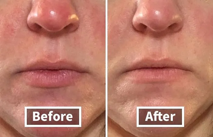 Filter? Nope, Just This Magical Primer!"  This   <a Style="Display:inline;" Href="Https://Www.amazon.com/Stila-Corrector-Brightening-Moisturize-Oil-Free/Dp/B003w5gl5i?ie=utf8&th=1&linkcode=ll1&tag=bppanda-20&linkid=56a72b39d77bb8cd84c46ad1f3f94c4c&language=en_us&ref_=as_li_ss_tl " Target="_blank"><span Style="Font: Inherit; Color: #d74b1f;"> Stila One Step Primer</Span> Will Have Your Skin Looking So Flawless, You'll Ditch The Instagram Filters For Good