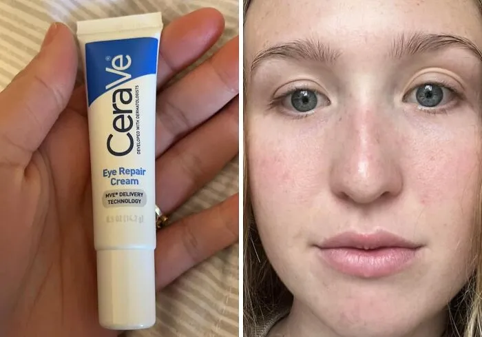Say Goodbye To 'Raccoon Eyes' And Hello To A Well-Rested Look!" This   <a Style="Display:inline;" Href="Https://Www.amazon.com/CeraVe-Repair-Cream-Circles-Puffiness/Dp/B00jjpmxdo?ie=utf8&linkcode=ll1&tag=bppanda-20&linkid=67d30f64ff1c204fa4439a0a437a8130&language=en_us&ref_=as_li_ss_tl " Target="_blank"><span Style="Font: Inherit; Color: #d74b1f;"> CeraVe Eye Cream</Span> Tackles Dark Circles And Puffiness Like A Boss, Leaving You Looking Bright-Eyed And Bushy-Tailed 