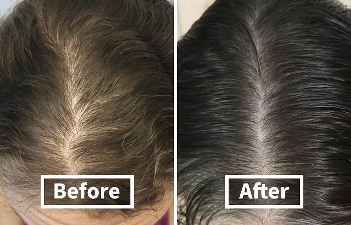Our Scalp Is About To Feel So Refreshed And Invigorated, It'll Be Doing The Happy Dance! This   <a Style="Display:inline;" Href="Https://Www.amazon.com/Biotin-Hair-Shampoo-Thinning-Moisturizing/Dp/B01encboa0?ie=utf8&linkcode=ll1&tag=bppanda-20&linkid=5d3ac03affed2ad151624527dd9e7605&language=en_us&ref_=as_li_ss_tl " Target="_blank"><span Style="Font: Inherit; Color: #d74b1f;"> Thinning Hair Shampoo</Span> Is The TLC Your Hair Deserves