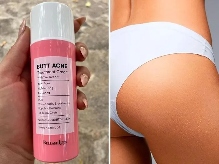 Bikini Season Got You Feeling A Little Cheeky? This <a Style="Display:inline;" Href="Https://Www.amazon.com/Bellamiluxx-Clearing-Extracts-Moisture-Buttocks/Dp/B08lsr6swg?ie=utf8&linkcode=ll1&tag=bppanda-20&linkid=74d3539db478805553668162753e7e50&language=en_us&ref_=as_li_ss_tl " Target="_blank"><span Style="Font: Inherit; Color: #d74b1f;"> Butt Acne Clearing Lotion</Span> Will Have Your Backside Beach-Ready In No Time!