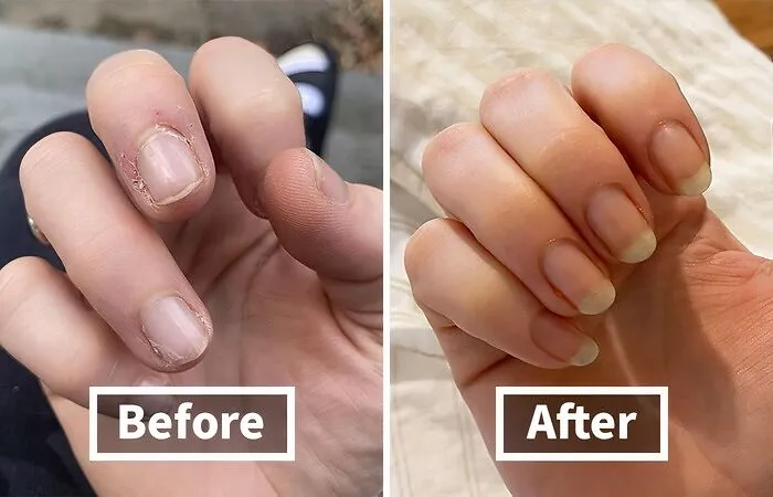 Give Your Nails The TLC They Deserve With This Luxurious   <a Style="Display:inline;" Href="Https://Www.amazon.com/Dp/B0037mimlw?ascsubtag=7729703%2c15%2c34%2cd%2c0%2c0%2cbf-Web-Hf%2c900%3a2%3b974%3a3%3b1125%3a1%3b1338%3a1%2c0%2c0%2c0%2c0&btn_ref=srctok-A2e746abc3c2324b&linkcode=ll1&tag=bpshark-20&linkid=8d2df19e8356af700fda507e5a5cfa79&language=en_us&ref_=as_li_ss_tl" Target="_blank"><span Style="Font: Inherit; Color: #d74b1f;"> Cuticle Oil</Span>