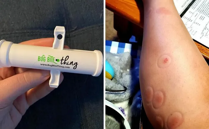 Mosquitoes Got You Itching Like Crazy? The <a Style="Display:inline;" Href="Https://Www.amazon.com/Bug-Bite-Thing-Suction-Remover/Dp/B01576dwqu?ie=utf8&linkcode=ll1&tag=bpcow-20&linkid=c8030d3a376272461dff2915b62bfb12&language=en_us&ref_=as_li_ss_tl" Target="_blank"><span Style="Font: Inherit; Color: #d74b1f;"> Bug Bite Thing</Span> Will Suck The Itch Away