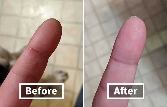 From Kitchen Burns To Playground Scrapes, This   <a Style="Display:inline;" Href="Https://Www.amazon.com/Active-Skin-Repair-Spray-Irritations/Dp/B07234gwjh?content-ID=amzn1.sym.140400a7-1208-46ad-8d2a-Eb6e8eac81b5%3aamzn1.sym.140400a7-1208-46ad-8d2a-Eb6e8eac81b5&crid=2idi00fdskrtz&cv_ct_cx=best+cleaning&dib=eyj2ijoimsj9.u95k5jdfn2353yvbq0-Usonj0ivfuscxelmdmductmre1n3a1wp5qejsjhva4axlqdqlntvbkxt1bzvbrkwxurw7r26-Kr8zszxv76lkbyq.q6dzusniqacxmwvcjgegj7k-Hgjxptist5utipalxhe&dib_tag=se&keywords=best+cleaning&pd_rd_i=b07234gwjh&pd_rd_r=3d885f00-E7c5-412d-B608-44afc76bb592&pd_rd_w=vhlsa&pd_rd_wg=i53tn&pf_rd_p=140400a7-1208-46ad-8d2a-Eb6e8eac81b5&pf_rd_r=xrqbt1ee69rfmc2r9fj1&qid=1727096121&sbo=rzvfv%2f%2fhxdf%2bo5021pansa%3d%3d&sprefix=best+clea%2caps%2c198&sr=1-1-6024b2a3-78e4-4fed-8fed-E1613be3bcce-Spons&sp_csd=d2lkz2v0tmftzt1zcf9zzwfyy2hfdghlbwf0awm&psc=1&linkcode=ll1&tag=bpshark-20&linkid=8ee678d8ba202653576020be31e6561d&language=en_us&ref_=as_li_ss_tl" Target="_blank"><span Style="Font: Inherit; Color: #d74b1f;"> Skin Repair Spray</Span> Tackles It All! It's The First-Aid Essential For Every Family.