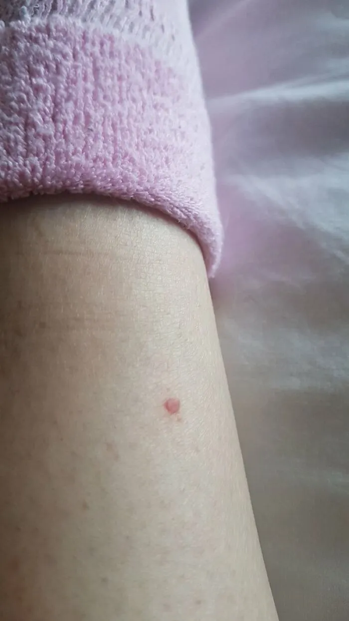30 Times People Didn’t Think Their Symptoms Were A Big Deal, But They Were