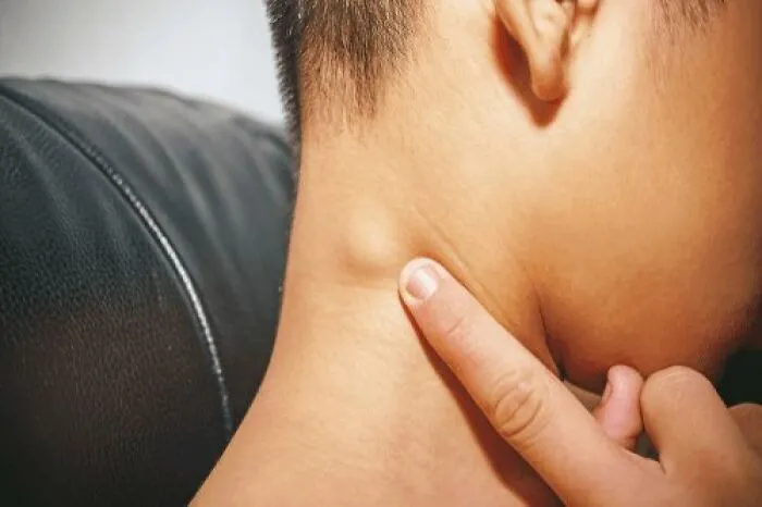 30 Times People Didn’t Think Their Symptoms Were A Big Deal, But They Were