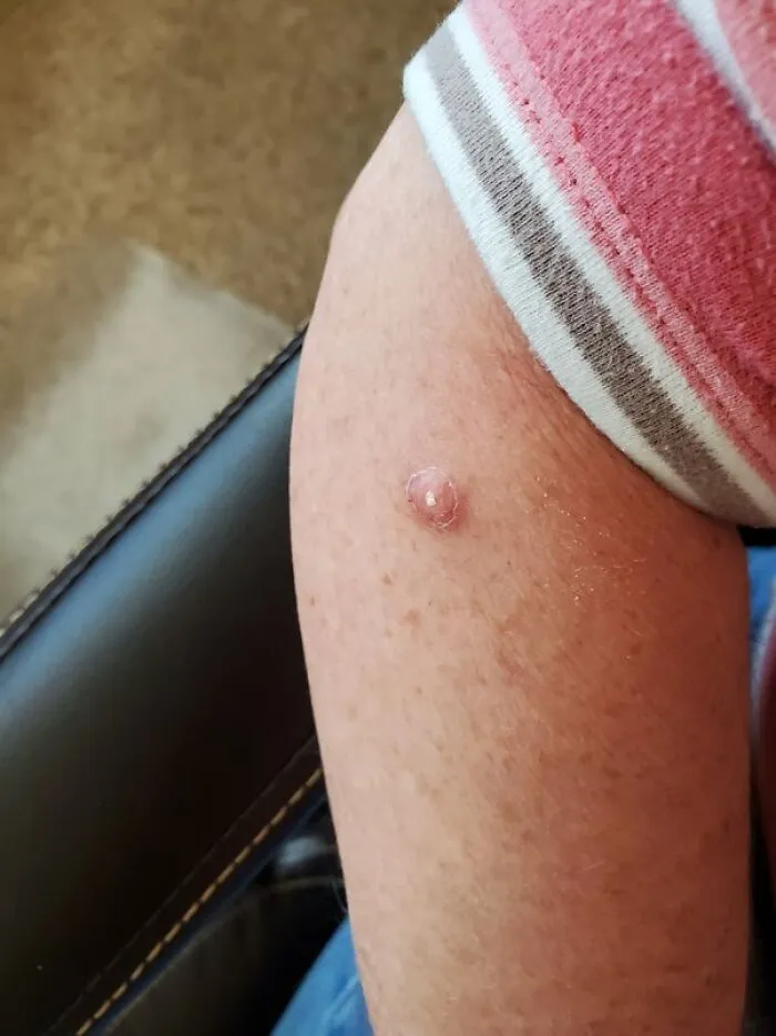 30 Times People Didn’t Think Their Symptoms Were A Big Deal, But They Were