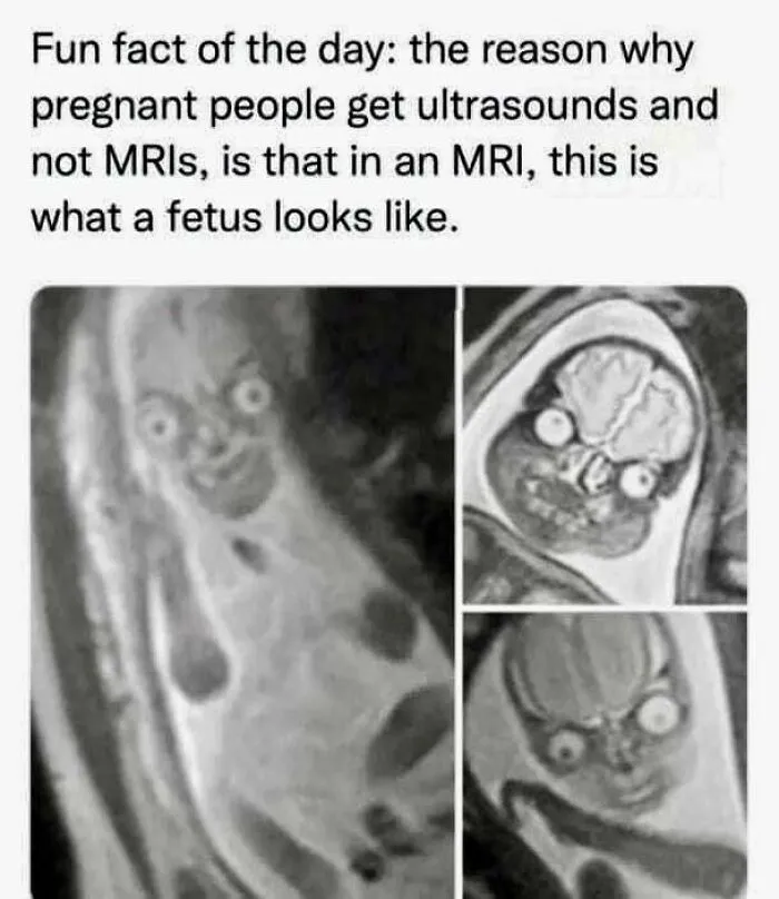 50 Posts From This FB Page Dedicated To “Amazing Facts And Unbelievable Things In The World” (New Pics)