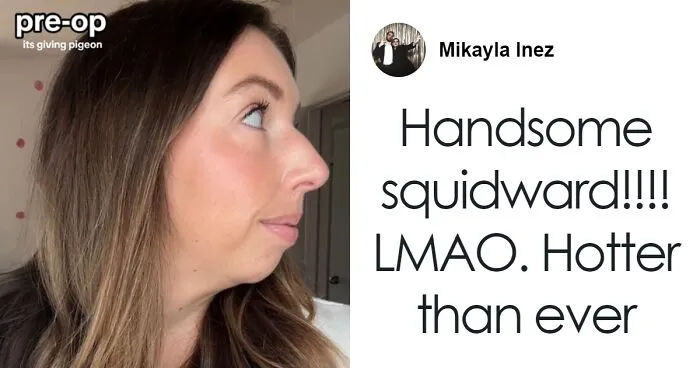 Woman Stuns Viewers With Surgery Results After Having Her “Jaw Of An 80-Year-Old” Fixed