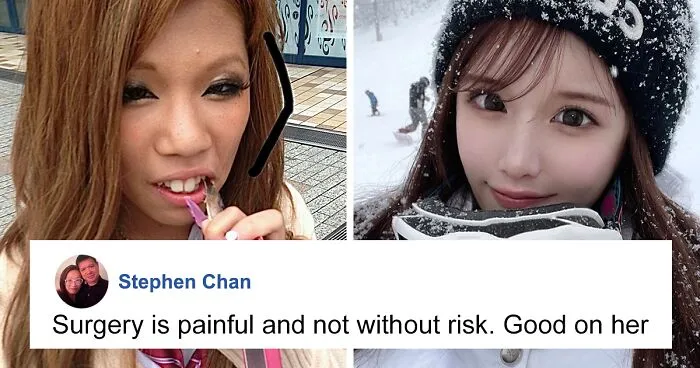 "Finally Beautiful": Japanese Model Becomes Unrecognizable After 20+ Plastic Surgeries