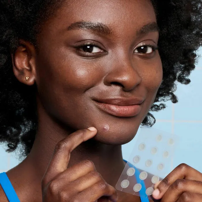 Hide N' Heal:<a Style="Display:inline;" Href=" Https://Www.amazon.com/Cosmetics-Mighty-Patchtm-Invisible-Patches/Dp/B0d38dmbpq?pd_rd_w=gl09i&content-ID=amzn1.sym.7379aab7-0dd8-4729-B0b5-2074f1cb413d&pf_rd_p=7379aab7-0dd8-4729-B0b5-2074f1cb413d&pf_rd_r=fz6gjqsrvk6dn0nhybad&pd_rd_wg=cxfax&pd_rd_r=f3caf047-E731-4a94-Bbeb-6549e65b5eac&pd_rd_i=b0d38dmbpq&psc=1&linkcode=ll1&tag=bpbeaver-20&linkid=e874e34e7fb21a342fb276240b2cee27&language=en_us&ref_=as_li_ss_tl  " Target="_blank"><span Style="Font:inherit;color:#d74b1f;"> Mini Invisible+ Patches</Span> For Pimple Problems