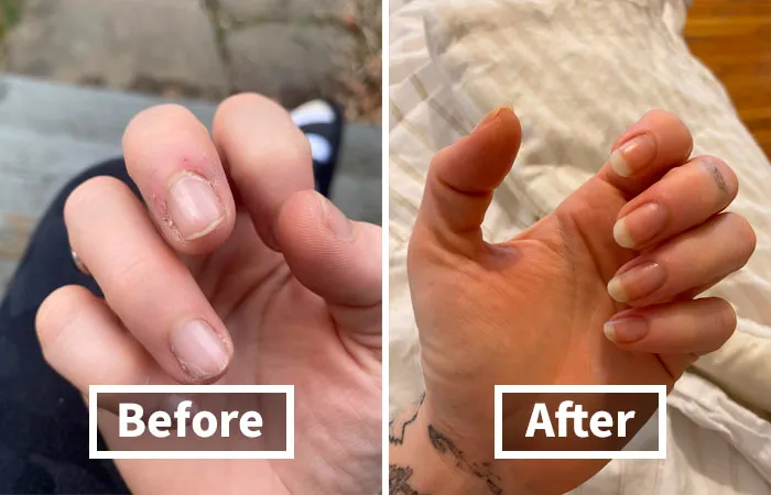 Revitalize Your Cuticles With <a Style="Display:inline;" Href=" Https://Www.amazon.com/Dp/B0037mimlw?ascsubtag=7729703%2c15%2c34%2cd%2c0%2c0%2cbf-Bshp%2c900%3a2%3b974%3a3%3b1125%3a3%3b1338%3a1%2c0%2c0%2c0%2cbf&btn_ref=srctok-87a40be3c64e5967&th=1&linkcode=ll1&tag=bplobster-20&linkid=aa9058b91551b468865007aa7e803dc4&language=en_us&ref_=as_li_ss_tl " Target="_blank"><span Style="Font:inherit;color:#d74b1f;"> Solaroil – The Ultimate Natural Moisturizer And Conditioner</Span>!