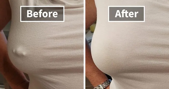 You're Not Alone: 22 Relatable Body Problems (And How To Fix Them)