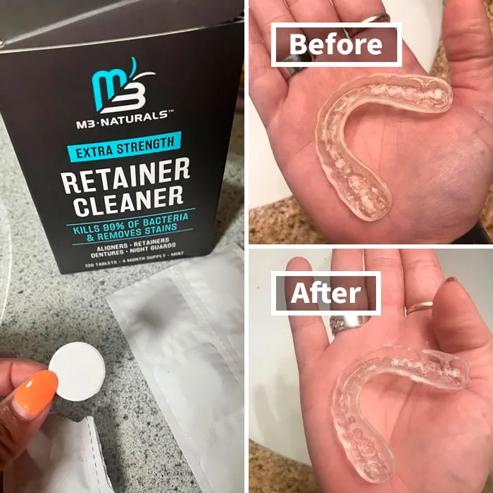 Your Retainer's About To Be Fresher Than Your Breath After A Mojito!  These   <a Style="Display:inline;" Href="Https://Www.amazon.com/Dp/B075wwybj7?ascsubtag=7737561%2c8%2c34%2cd%2c0%2c0%2c0%2c900%3a2%3b974%3a3%3b1125%3a1%3b1338%3a1%2c0%2c0%2c0%2cbf&btn_ref=srctok-C9f4eb70b4d63ddb&th=1&linkcode=ll1&tag=bpgazelle-20&linkid=7dad045acd71eb76175eb94c552bc852&language=en_us&ref_=as_li_ss_tl" Target="_blank"><span Style="Font: Inherit; Color: #d74b1f;"> Cleanser Tablets</Span> Will Banish Bad Odors And Keep Your Smile Sparkling