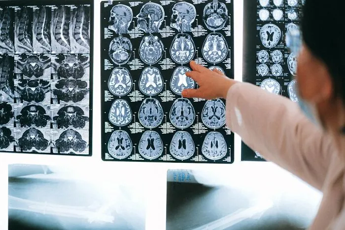 30 Times People Didn’t Think Their Symptoms Were A Big Deal, But They Were