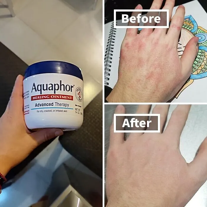    <a Style="Display:inline;" Href="Https://Www.amazon.com/Aquaphor-Healing-Ointment-Moisturizing-Protectant/Dp/B006ib5t4w?pd_rd_w=s37fp&content-ID=amzn1.sym.7379aab7-0dd8-4729-B0b5-2074f1cb413d&pf_rd_p=7379aab7-0dd8-4729-B0b5-2074f1cb413d&pf_rd_r=mgmkpdv0drywsz93fhwk&pd_rd_wg=3ukyv&pd_rd_r=6e765874-Dd49-4256-Ace4-4e364e69f58f&pd_rd_i=b006ib5t4w&psc=1&linkcode=ll1&tag=bpbat-20&linkid=3e845a052e0a80d1ad1c2978467874e8&language=en_us&ref_=as_li_ss_tl" Target="_blank"><span Style="Font:inherit;color:#d74b1f;"> Aquaphor Healing Ointment</Span> Is A Tried And Tested Favorite That Remains A Trending Choice For Savvy Shoppers