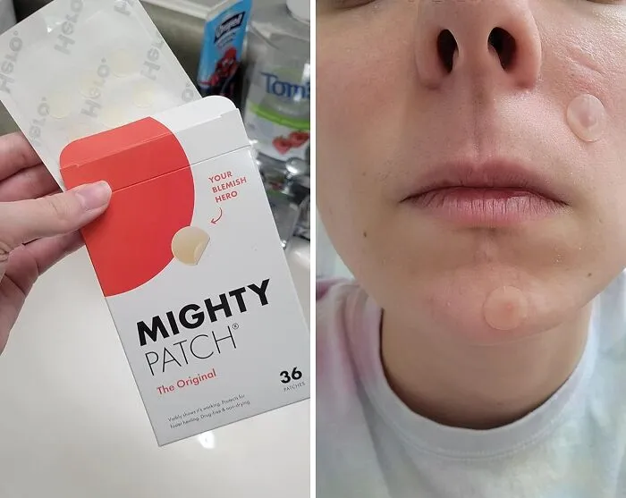 Your Zit Zapper Has Arrived! The   <a Style="Display:inline;" Href="Https://Www.amazon.com/Mighty-Patch-Hydrocolloid-Absorbing-Count/Dp/B074pvtpbw?pf_rd_p=53d84f87-8073-4df1-9740-1bf3fa798149&pf_rd_r=1gef1cph506fp7e9w37h&sbo=rzvfv%2f%2fhxdf%2bo5021pansa%3d%3d&linkcode=ll1&tag=bpbuffalo-20&linkid=22793bba1236e9c0e249772497cfb17e&language=en_us&ref_=as_li_ss_tl" Target="_blank"><span Style="Font: Inherit; Color: #d74b1f;"> Mighty Patch Hero Cosmetics Patch</Span> Is The Secret Weapon For Banishing Pesky Pimples Overnight