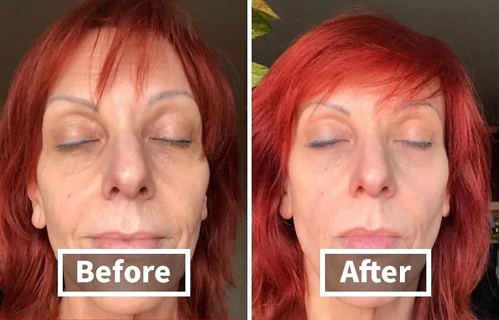 Give Your Tired Eyes A Wake-Up Call Without The Caffeine Jitters Using This Revitalizing <a Style="Display:inline;" Href="Https://Www.amazon.com/Dp/B00lv6vdg2?ascsubtag=7625187%2c3%2c63%2cd%2c0%2c0%2c0%2c900%3a2%3b974%3a3%3b1125%3a1%3b1338%3a1%3b1352%3a2%2c43653438%2c0%2c0%2c0&btn_ref=srctok-E830cefeb1171787&linkcode=ll1&tag=bpemu-20&linkid=93e15d2bef8cdcbd87f5d0554753a233&language=en_us&ref_=as_li_ss_tl" Target="_blank"><span Style="Font: Inherit; Color: #d74b1f;"> Lilyana Naturals Eye Cream For Dark Circles And Puffiness </Span>
