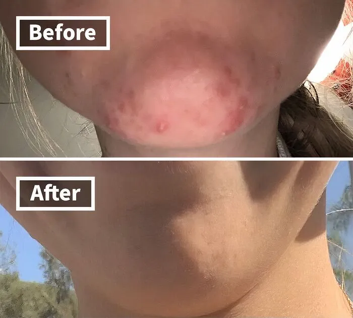 Reveal Your Glowiest Skin Yet With These Complexion-Transforming   <a Style="Display:inline;" Href="Https://Www.amazon.com/Glycolic-Resurfacing-Vitamins-Calendula-Allantoin/Dp/B07jqg2wf5?crid=1ljclhdhsvomf&dib=eyj2ijoimsj9.betjul0skedslpwq9gdjxif-Rbv9gcfgb0h09ncrhxnrkvqwq1g2piwdnk-Pp3kbuyfi3ut_ujsskqk9avs81nzt8xalslruxig0uce7d597d7yticaahumau4xi6evxilg6e4erfrjx0xtyuwv18gzccotl23ek63pcfoqufbnglqbzh-Berblianirns0d_qbhphptucw0ksaw8gc-Ck2w5pqv7ghchiwib5mcca1on7exo3hefarm28ycwffn8uzgprcnmd1loj4xfhga7fnmwbqalvrggqrcdqccxoy.hombv-Wpf_c-Rdh75b5vtfwd__2qzczak4jtpsedjwy&dib_tag=se&keywords=best+sellers&qid=1728378272&sprefix=best+sellers+%2caps%2c244&sr=8-50-Spons&sp_csd=d2lkz2v0tmftzt1zcf9tdgy&psc=1&linkcode=ll1&tag=bpcoyote-20&linkid=26602012cf81c7c1e1768d0ef923b38b&language=en_us&ref_=as_li_ss_tl" Target="_blank"><span Style="Font: Inherit; Color: #d74b1f;"> Glycolic Acid 20% Resurfacing Pads</Span> That'll Have You Feeling Like You Just Got A Facial From The Comfort Of Your Own Bathroom