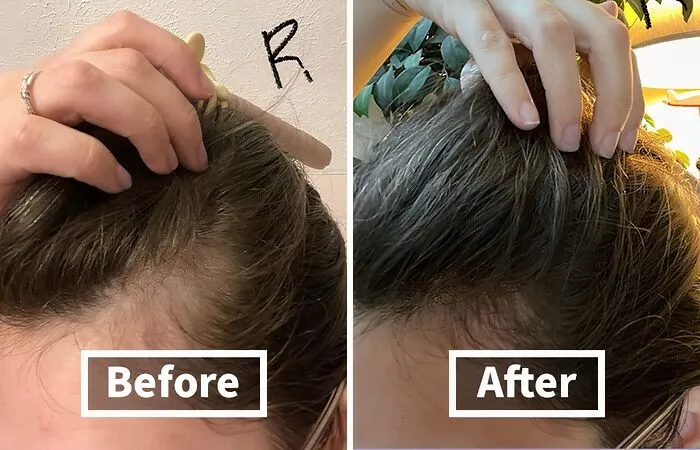 Give Your Lackluster Locks A New Lease On Life With This Hair-Reviving   <a Style="Display:inline;" Href="Https://Www.amazon.com/Pura-Dor-Anti-Thinning-Moisturizing-Conditioner/Dp/B07bhcb9y2?crid=1ljclhdhsvomf&dib=eyj2ijoimsj9.betjul0skedslpwq9gdjxif-Rbv9gcfgb0h09ncrhxnrkvqwq1g2piwdnk-Pp3kbuyfi3ut_ujsskqk9avs81nzt8xalslruxig0uce7d597d7yticaahumau4xi6evxilg6e4erfrjx0xtyuwv18gzccotl23ek63pcfoqufbnglqbzh-Berblianirns0d_qbhphptucw0ksaw8gc-Ck2w5pqv7ghchiwib5mcca1on7exo3hefarm28ycwffn8uzgprcnmd1loj4xfhga7fnmwbqalvrggqrcdqccxoy.hombv-Wpf_c-Rdh75b5vtfwd__2qzczak4jtpsedjwy&dib_tag=se&keywords=best+sellers&qid=1728378272&sprefix=best+sellers+%2caps%2c244&sr=8-52-Spons&sp_csd=d2lkz2v0tmftzt1zcf9tdgy&psc=1&linkcode=ll1&tag=bpcoyote-20&linkid=e28569d94fb3e9e26d9e581b0d09d652&language=en_us&ref_=as_li_ss_tl" Target="_blank"><span Style="Font: Inherit; Color: #d74b1f;"> Anti-Thinning Biotin Shampoo & Deep Moisturizing Conditioner </Span> That'll Have You Flipping Your Hair Like You're In A Shampoo Commercial
