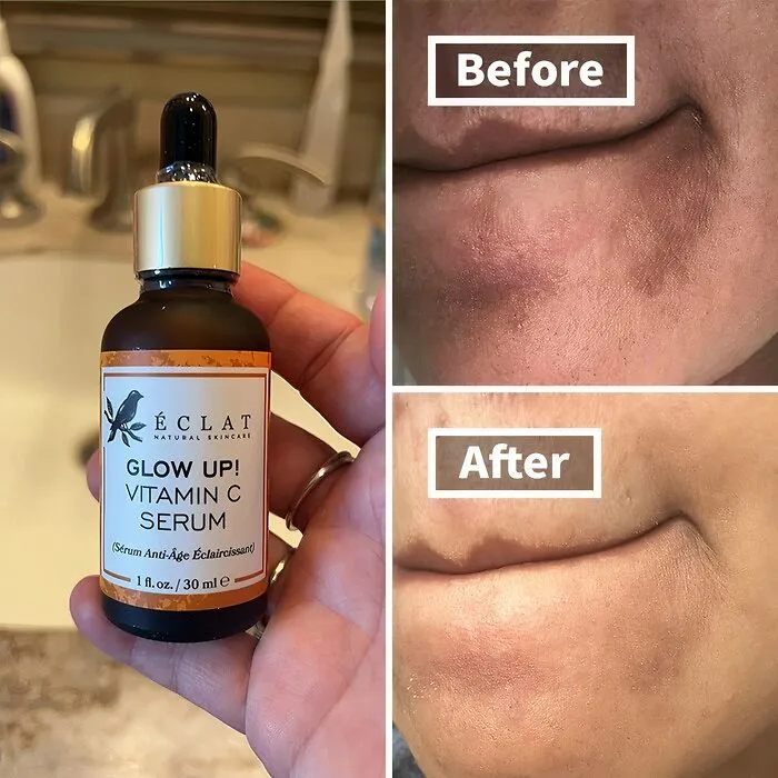 Banish Those Pesky Dark Spots And Unleash Your Inner Glow With This Powerhouse   <a Style="Display:inline;" Href="Https://Www.amazon.com/Vitamin-Serum-Face-Ageing-Brightening/Dp/B07p5tmhd9?crid=1ljclhdhsvomf&dib=eyj2ijoimsj9._wn8ubpeuxhlbaacjpjkg9uu4exatj9gpnci9qwen9ej0lryebzuw2pnqinm32wjx9ir1zxwakonbbalacwxtfonkfha1mlr4qc4cykv1j_tanfg54x01ixzysw5uzifsaqgi8474evmxbgsdmmodda6kqeqei7pnfvjljevhcygwm1rizrdiyzsnrqkldaigqreb9zirxvsm6nvhksiikctvbzzpypuzck3cr0qfknisvyv8ozkyynxbjsua3wid2b4qus8u9c28gok-Uud1s7_iyvpdn-Ze_lxfjf2p6g.lvs4rhi-2_ziivho9o3yaav1pbvfmk8qqxwphvree60&dib_tag=se&keywords=best+sellers&qid=1728378383&sprefix=best+sellers+%2caps%2c244&sr=8-127&linkcode=ll1&tag=bpcoyote-20&linkid=4f65cb248b35896b4ed67973a64fd7da&language=en_us&ref_=as_li_ss_tl" Target="_blank"><span Style="Font: Inherit; Color: #d74b1f;"> Vitamin C Dark Spot Remover Facial Serum </Span>