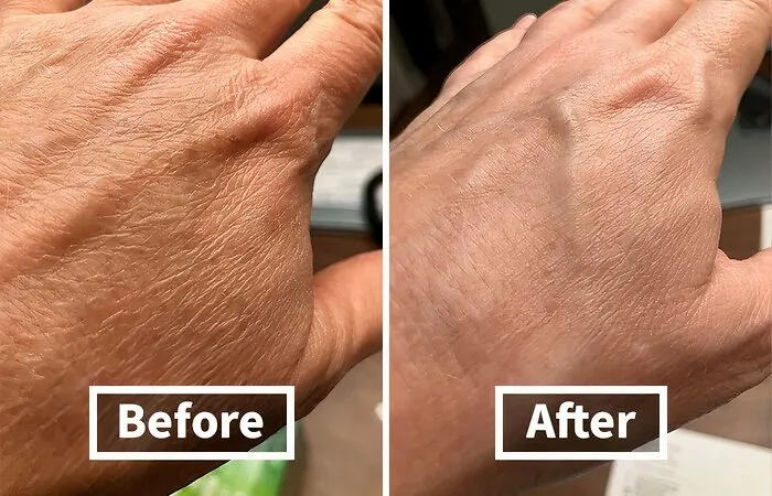 Turn Back The Clock On Your Skin And Say Goodbye To Crepey Arms With This Fountain-Of-Youth-In-A-Bottle   <a Style="Display:inline;" Href="Https://Www.amazon.com/Gold-Bond-Corrector-Smoothing-Concentrate/Dp/B08yqx3skh?crid=1ljclhdhsvomf&dib=eyj2ijoimsj9.egankcnaikjgi1k7or-_p56b3btmw2lpztg3edmkn5u3mwpbbuaane2r9bguev6gwu4fuvgd0diav_9uapfdfjvpl1zb1quhoalqmvzx24gxglfjj24pqyxobxgrzab5zurb5k3wl75qxosimjnt1tmk-Evmulg-Btxjym-X0tqaddcamnw-26hgorq1d3f7hizmwpde7ajq8eb8dbzygbyqznaycxd3nq4ay3jcqrw52jzrzqcs6s1cfqepbssn9acxvpysbvwkrzn9xc4d6hnnlsnxuqteiwvo7igctp8.caew4ftj7nn0bm2hdpozfcdyy-Fp1x7jy6wnzndx8w0&dib_tag=se&keywords=best+sellers&qid=1728374559&sprefix=best+sellers+%2caps%2c244&sr=8-21-Spons&sp_csd=d2lkz2v0tmftzt1zcf9tdgy&psc=1&linkcode=ll1&tag=bpcoyote-20&linkid=d3c45b00159ae5d9d002f70c4fabe9c2&language=en_us&ref_=as_li_ss_tl" Target="_blank"><span Style="Font: Inherit; Color: #d74b1f;"> Age Renew Crepe Corrector Body Lotion </Span>