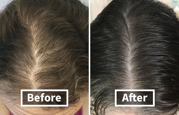 Thinning Locks Meet Their Match With This Powerhouse   <a Style="Display:inline;" Href="Https://Www.amazon.com/Biotin-Hair-Shampoo-Thinning-Moisturizing/Dp/B01encboa0?ie=utf8&linkcode=ll1&tag=bpcrab-20&linkid=58011b5d2ecec328715fd100693e4e55&language=en_us&ref_=as_li_ss_tl" Target="_blank"><span Style="Font: Inherit; Color: #d74b1f;"> Rosemary And Biotin Shampoo For Thinning Hair</Span>