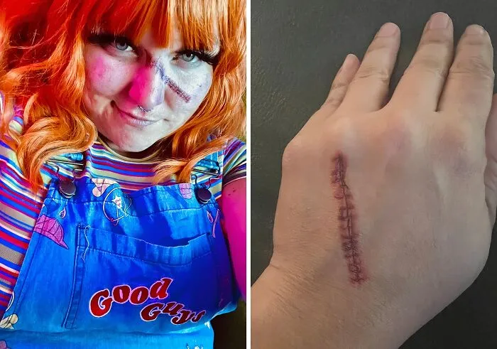 Add A Gruesome Gash To Your Halloween Look With This <a Style="Display:inline;" Href="Https://Www.amazon.com/Realistic-Waterproof-Temporary-Halloween-Masquerade/Dp/B0cbkxrf4z?crid=cjqhtyw1fr6&dib=eyj2ijoimsj9.7b7gknm6qwmwh9zj5g8fmyvbkhb-Jkleevzcdtw4vfwrqfopdfc4v4dnou1mflxkxnz2yjrzogtpooq2c-Qtbg0kibpeyeksazccbvfip2lvzoxtsvo-Vpo8jphf3qu4o97yyyrpvqwbtgroahqcwn1oayl_oqa4fx4marffbo8fuloae7cgufeubhxybhsnvkxuoefm2nkcefmrnrnp74nt3n0tjj8o9fu615jf4gspypi3tilid03h3mdhclj0i8c_nxqat-Age4uhtdxil4uyr6wlblresurahkfyia8.tpbeuyvvm2dlmegxg2-Gswqq-Eogfivrkzyvcu3ra-G&dib_tag=se&keywords=halloween+makeup&qid=1728972432&sprefix=haloween+m+akeu%2caps%2c214&sr=8-179&linkcode=ll1&tag=bphyena-20&linkid=9a450d148733d7c4b76f6bc0ef3df10f&language=en_us&ref_=as_li_ss_tl" Target="_blank"><span Style="Font: Inherit; Color: #d74b1f;"> Fake Wound Temporary Tattoo Sticker </Span> That's Sure To Make You Look Like A Victim Of A Terrifying Attack