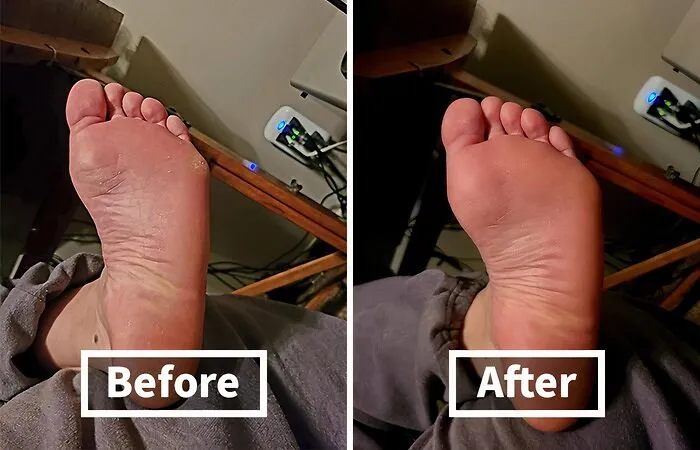 Tired Of Your Feet Looking Like They Belong On A Hobbit? This   <a Style="Display:inline;" Href="Https://Www.amazon.com/Dp/B00xuvkb14?ascsubtag=7638669%2c2%2c28%2cd%2c0%2c0%2c0%2c900%3a2%3b974%3a3%3b1125%3a1%3b1338%3a1%3b1352%3a1%2c44342088%2c0%2c0&ie=utf8%25252c0%252c0%2c0&aa_adgroupid=wyrd_4c10010495f1284_2&aa_campaignid=wyrd_72dd07f686de0fb_2&maas=maas_adg_api_583495020295543269_static_9_218&aa_creativeid=wyrd_9354f3bb67fe32a_2&btn_ref=srctok-C02e8c032394e64a&linkcode=ll1&tag=bpmonkey-20&linkid=adbd011cf9917603b028c987b7a9c838&language=en_us&ref_=as_li_ss_tl" Target="_blank"><span Style="Font: Inherit; Color: #d74b1f;"> Foot File Callus Remover </Span> Will Fix You Right Up