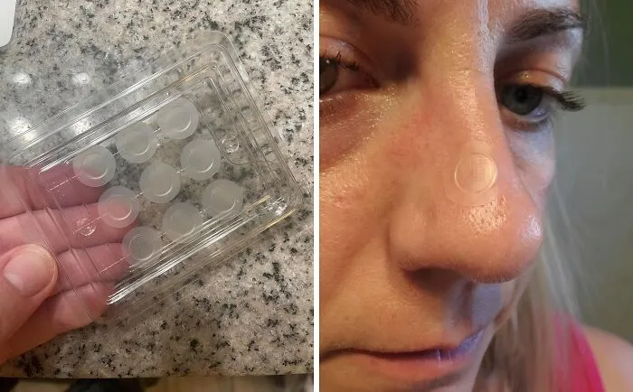 Zits Got You Feeling Prickly? These   <a Style="Display:inline;" Href="Https://Www.amazon.com/1herolabs-Microdart-Acne-Patch-Hyaluronate/Dp/B0cxt7m9xl?crid=drboj7bj1z8w&dib=eyj2ijoimsj9.in6yzyhqxcj_tmda66pgcomnyoejb9wqwfhbvohrveqk2v-Mauhfsaqczjcxbpps7mwpiyd9vknoaqmhdupm3iyfawdzdy4lvbkxuhp8heoifwvqgn_tb0k2ynwm4_qzsk5p13sbmvhrqqi6yu8_en4ukh-Ol8f1fxixpsl2eca-Xaqferjnk_kcvswfl-Px.hqgwxxrwob7eo21ztu4s8iwz-Kkicvihgrwkspkp68i&dib_tag=se&keywords=embarrassing+issues&qid=1729519296&sprefix=embarasing+issue%2caps%2c190&sr=8-24&linkcode=ll1&tag=bpmonkey-20&linkid=bd9bcf93b79c9dd002f3d7f46a9e8467&language=en_us&ref_=as_li_ss_tl" Target="_blank"><span Style="Font: Inherit; Color: #d74b1f;"> Microdart Pimple Patches </Span> Are Like Tiny Ninjas, Sneaking In To Shrink Those Blemishes And Leave Your Skin Smooth And Clear