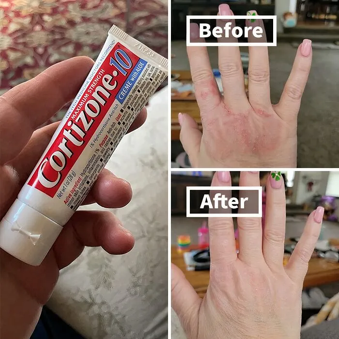Itchy Skin Driving You Crazy? This   <a Style="Display:inline;" Href="Https://Www.amazon.com/Cortizone-10-Strength-Soothing-Anti-Itch-Hydrocortisone/Dp/B0bjmqbskj?pd_rd_w=kykla&content-ID=amzn1.sym.31346ea4-6dbc-4ac4-B4f3-Cbf5f8cab4b9&pf_rd_p=31346ea4-6dbc-4ac4-B4f3-Cbf5f8cab4b9&pf_rd_r=9tr5185sxjwd1a9wjxdj&pd_rd_wg=l8xbx&pd_rd_r=af6b4968-D0c6-4bbd-A8fb-54947dc111c7&pd_rd_i=b0bjmqbskj&psc=1&linkcode=ll1&tag=bpmonkey-20&linkid=debcafbc0c0794c01a2de97793726697&language=en_us&ref_=as_li_ss_tl" Target="_blank"><span Style="Font: Inherit; Color: #d74b1f;"> Maximum Strength Anti-Itch Cream </Span> Will Soothe That Irritation And Have You Feeling Zen In No Time