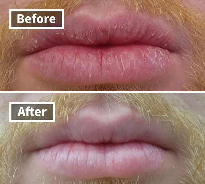 Nourish And Repair Dry, Chapped Lips With The <a Style="Display:inline;" Href="Https://Www.amazon.com/Okeeffes-Repair-Night-Treatment-Ounce/Dp/B07qj26dt1?ie=utf8&linkcode=ll1&tag=bpgoose-20&linkid=06533e1b086ae9a8b14e0ec98d79b6c8&language=en_us&ref_=as_li_ss_tl" Target="_blank"><span Style="Font: Inherit; Color: #d74b1f;"> O'keeffe's Lip Repair Night Treatment</Span>, A Rich And Rejuvenating Formula That Works While Your Kiddos Sleep
