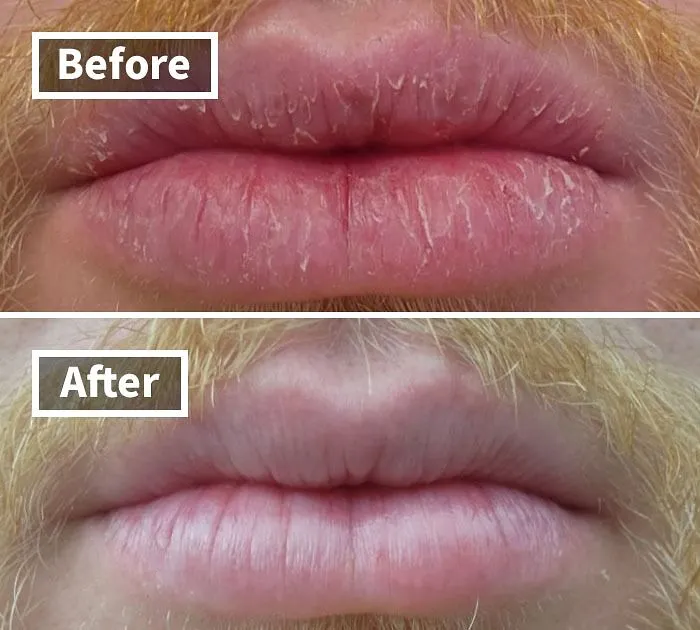 Your Lips Are About To Get A Kiss From The Night! This   <a Style="Display:inline;" Href="Https://Www.amazon.com/Okeeffes-Repair-Night-Treatment-Ounce/Dp/B07qj26dt1?ie=utf8&linkcode=ll1&tag=bpsparrow-20&linkid=30072d2877b12960143fb4a0431008e7&language=en_us&ref_=as_li_ss_tl" Target="_blank"><span Style="Font: Inherit; Color: #d74b1f;"> O'keeffe's Lip Repair Night Treatment Lip Balm</Span> Is The Perfect Way To Soothe And Repair Your Lips While You Sleep