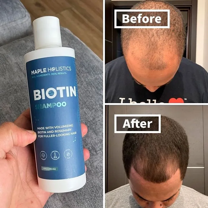 "I searched for conditioner and found a bottle of something for hair that wasn't shampoo with a generic picture of a woman with beautiful hair...Turns out it was that country's version of Nair. I would have spent the next two months wandering around a foreign country half bald." - <span Style="Font:inherit;color:#808080"> Floomby</Span>