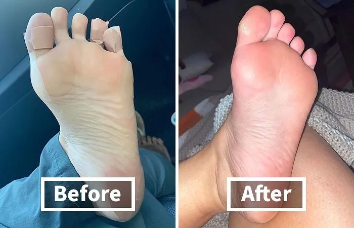 Soothe Your Soles With The   <a Style="Display:inline;" Href="Https://Www.amazon.com/Dr-Fredericks-Original-Blister-Bandages/Dp/B07lcrx2m7?ie=utf8&linkcode=ll1&tag=bplemon-20&linkid=ac4e47fab7a01b2c84fda6d5a56fab7b&language=en_us&ref_=as_li_ss_tl" Target="_blank"><span Style="Font: Inherit; Color: #d74b1f;"> Blister Bandages</Span>, Because Sometimes You Just Need A Little Extra TLC For Your Tired Tootsies, Especially After A Killer Hike 