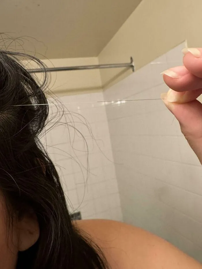 Puedes ver dónde empezó a crecerme el pelo blanco en lugar de mi color natural
