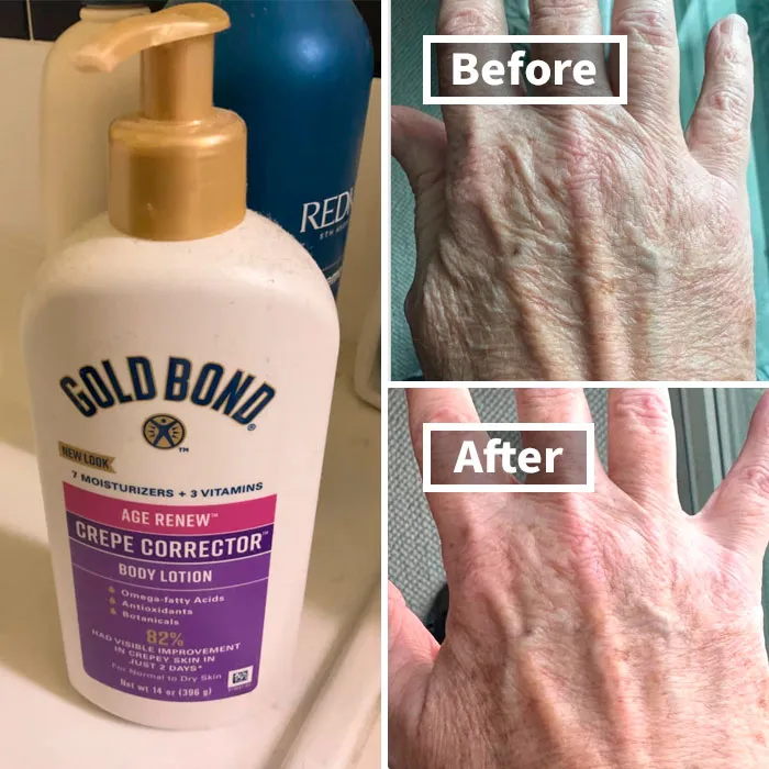 Dry Winter Skin Got You Down? Gold Bond's Got You Covered With The <a Style="Display:inline;" Href="Https://Www.amazon.com/Gold-Bond-Corrector-Smoothing-Concentrate/Dp/B08yqx3skh?dib=eyj2ijoimsj9.z66r_swjvjl2wtz8kntx93liolbudiexcl7wwyoe1erefkmianw3t0lbmdts4-Ov-Exwe2ntxvzv_lsdskeb-Xr4p13q1yxkq0cbujpbsudljyklouck84wbat57urgpdnumfjjzc2uyeh7bfvoc-Hrc0wfxnogbnr3wzi1oidpkkelv42_unaal0zzmniwdadakbu2vawh05g4_tuqybgjkopcbvus7avcog2qnlzweacdqbtkdkpgd9hnm0hql_mukn3xdpz4mmfy2huxmd6qlkqcshrfxqwp6dr8fc5o.r9qwpjwfoch3cleztyk24o_uxarncjwyba-8fy59mr0&dib_tag=se&keywords=hand%2blotion&qid=1729854505&sr=8-3-Spons&sp_csd=d2lkz2v0tmftzt1zcf9hdgy&th=1&linkcode=ll1&tag=bpfrog-20&linkid=3c2ab53df59da7e4985f6d5478aa9490&language=en_us&ref_=as_li_ss_tl" Target="_blank"><span Style="Font: Inherit; Color: #d74b1f;"> Crepe Corrector Body Lotion</Span> - Soft, Smooth Skin In No Time!