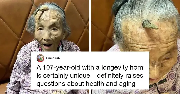 "It's Too Risky": 107YO Goes Viral For 4-Inch "Longevity Horn" Growing From Her Forehead