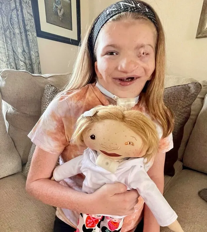 Woman Creates Dolls That Fit Each Child’s Needs While Representing Their Rare Health Conditions (26 New Pics)