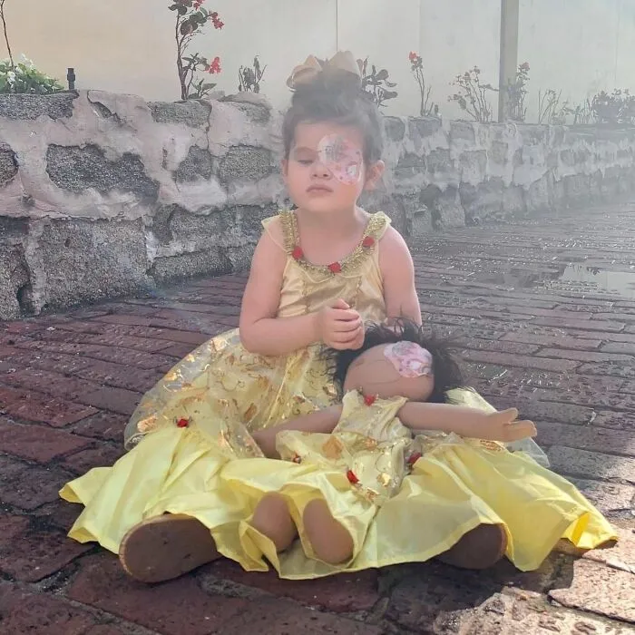 A young girl in a yellow dress sits with a doll, both representing rare health conditions with unique facial markings.