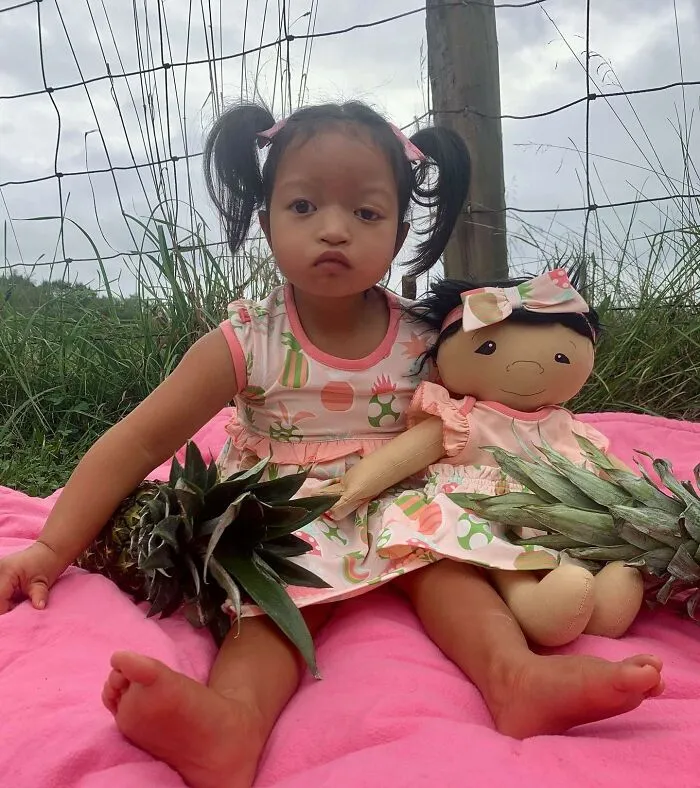 A little girl with a rare health condition sits outdoors with her doll, reflecting their shared uniqueness.