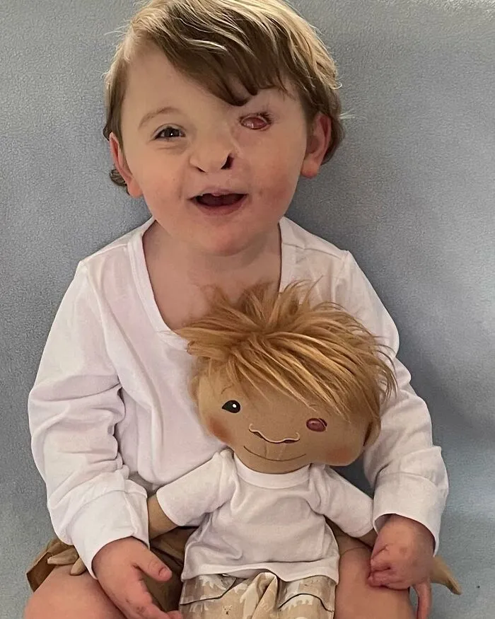 Woman Creates Dolls That Fit Each Child’s Needs While Representing Their Rare Health Conditions (26 New Pics)