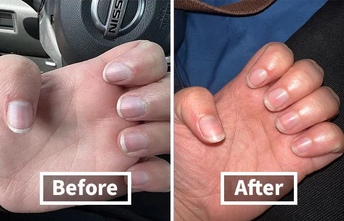 Soothe Dry Winter Cuticles With The Nourishing <a Style="Display:inline;" Href="Https://Www.amazon.com/Onsen-Cuticle-Cream-Deep-Action/Dp/B08vv26w43?crid=1ysh8x7qhtbma&dib=eyj2ijoimsj9.b1cqzykp2etzenx62jxdtnexqdxbl9gwzqenoefbt9itncrtzleoyftviktnoyozctfx-5mz0haec6cxhy8l7bj13tqbykxepchq3ihgixi8xtakdx2dl20sdtrmte-Aesgshntlwdxu0irme9hjdxpsmfshdsc-Hugw9x-Tozrttt5aupswyllxd3fxndp3qr43k6ls1sqdz3q01_hpamd3_8a1djr8hctkj0edwzousfrlaiv_t5b4b6-0vrndftuywgddn3anmir3jzhmt2cke10jaf_2eiqiuwyqdqo.vyeuoezgamiltea2_zq-Bnssyphubbcth0oapd1ja6c&dib_tag=se&keywords=nail%2bmoisturizer%ef%bf%bc&qid=1729850465&sprefix=nail%2bmoi%2caps%2c210&sr=8-2-Spons&sp_csd=d2lkz2v0tmftzt1zcf9hdgy&th=1&linkcode=ll1&tag=bpfrog-20&linkid=0d159b2c593a260b85d3aa3a3eed4b5c&language=en_us&ref_=as_li_ss_tl" Target="_blank"><span Style="Font: Inherit; Color: #d74b1f;"> Cuticle Cream</Span>