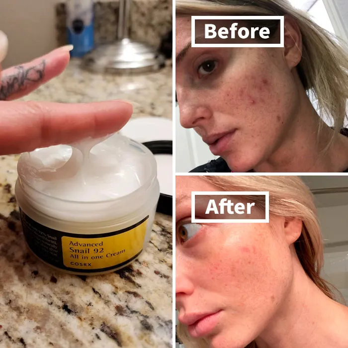 Repair And Hydrate Dry, Chapped Winter Skin With The Potent <a Style="Display:inline;" Href="Https://Www.amazon.com/COSRX-Moisturizer-Acne-Prone-Sensitive-Parabens/Dp/B01lej5msk?crid=5cuibxdydeet&dib=eyj2ijoimsj9.3rmzklz4iovxo8xcpcndt9c3x3tc_-Xc7ajhcqcsxnsswllhdbbkffg6ezf2txbbek7oohnqhj5fjsrpjl5chlbwurjifdaorcx357-Xslhjttoyz50ceoklskkorsuereumibcoydcxbm8cjokrfd1inmh4urpzfjmnq_xqfrqloglu_9cfnaqmtsm21rhdytl8zwmzpl6jgk03ltu-1i8mnhdutzb1mtsnbzup0aiubp0jrx_cylu8juka90bxgb_cujof-Yurb500k89gau1jrrpcopwtlwyvxkdles8.lg48sjlvz-7rc-Y_1s57be58sqkypu52w28zpibqlmg&dib_tag=se&keywords=face%2bmoisturizer%2bfor%2bextra%2bdry%2bskin&qid=1729852825&sprefix=face%2bmoisturizer%2bfor%2bextra%2bdry%2bskin%2caps%2c210&sr=8-7&th=1&linkcode=ll1&tag=bpfrog-20&linkid=1fed3fae8a4fd097462016d6ff14a994&language=en_us&ref_=as_li_ss_tl" Target="_blank"><span Style="Font: Inherit; Color: #d74b1f;"> COSRX Snail Mucin 92% Repair Cream</Span>