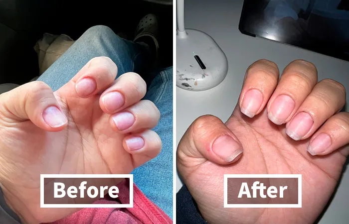"Have you tried using jojoba oil on your nails? It helps them grow like crazy if you want them longer. You have to be consistent and apply it a few times a day but it works!" - <span Style="Font:inherit;color:#808080"> vanimbeauty</Span>