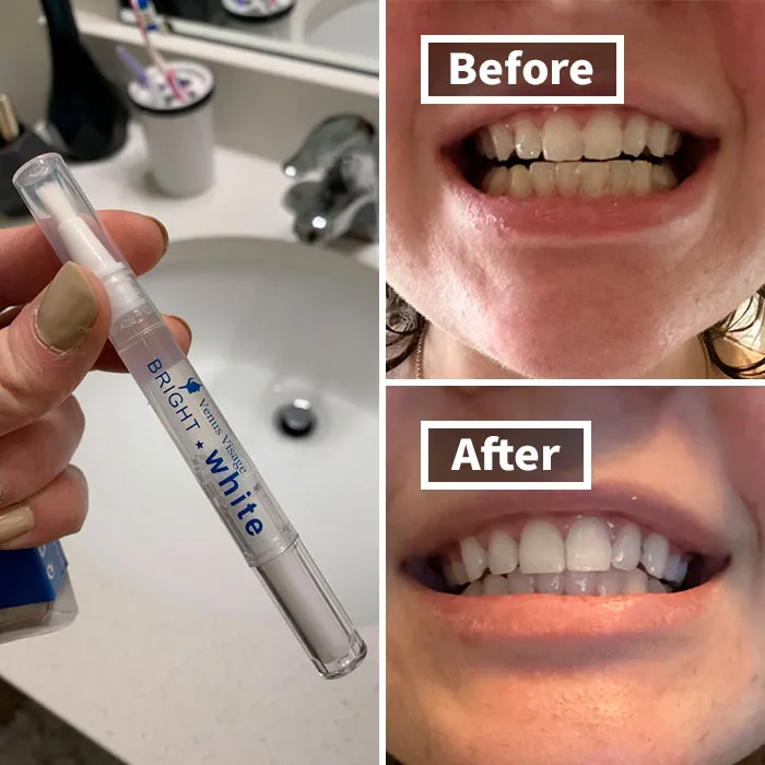 A Painless Path To A Perfect Smile: Countless Reviewers Are Thanking Their Lucky Stars For Discovering The <a Style="Display:inline;" Href="Https://Www.amazon.com/Dp/B082x2gsgj?ascsubtag=7408319%2c23%2c55%2cd%2c0%2c0%2cbf-Ssrch%2c900%3a2%3b974%3a3%3b1125%3a2%3b1338%3a1%3b1352%3a1%2c29076334%2c0%2c0%2c0&aa_adgroupid=lv_pixtygfvjsxxfygpuc&aa_campaignid=lv_shguctyxdnn7jwyfot&m=a25pr0qnnjanye&maas=maas_adg_api_583111570380551448_static_9_129&aa_creativeid=lv_nl4na37olagn6rd4cz&btn_ref=srctok-B6d2759f0b83ca90&th=1&linkcode=ll1&tag=bpaxolotl-20&linkid=436d1aefb1eea9172214134e53ef8135&language=en_us&ref_=as_li_ss_tl" Target="_blank"><span Style="Font: Inherit; Color: #d74b1f;"> Venus Visage Teeth Whitening Pen </Span>