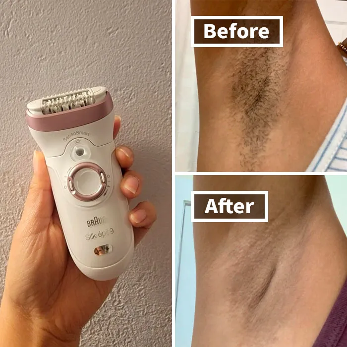 "Just buy an epilator and you don’t have to do yoga in the shower to shave. it’s cheaper and less messy than waxing, and it only hurts the first time. Kind of similar to getting a tattoo after that" - <span Style="Font:inherit;color:#808080"> Ramblingsofthewriter</Span>