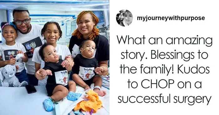 "So Grateful": Mom Of Successfully Separated Conjoined Twins Reveals They Went Home After A Year